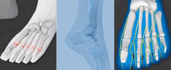 video of foot pain