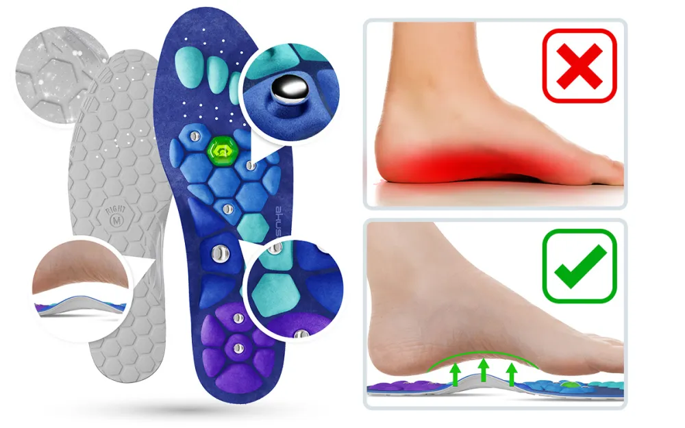 feet before and after Akusoli insoles