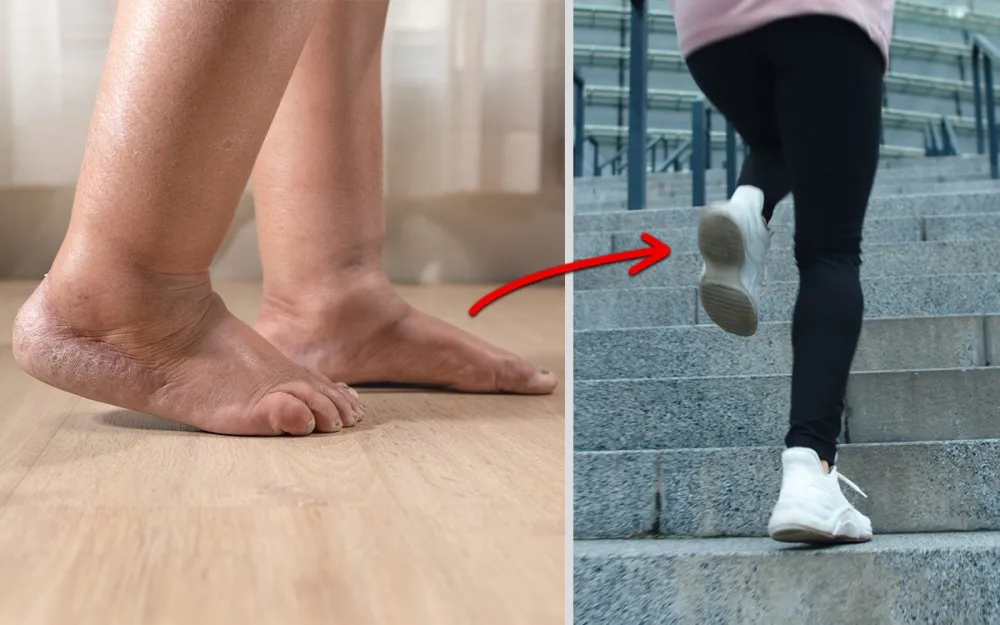 Akusoli before and after